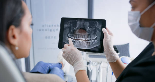 Licensed Tooth Extraction service in Palm Springs, CA - Smile Center Dentistry